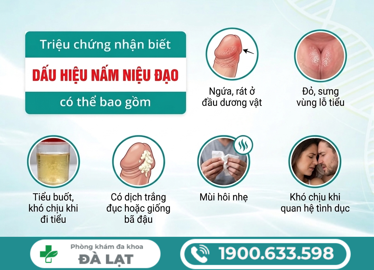 Hình ảnh minh họa